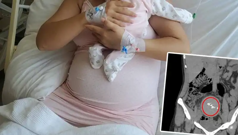 Gazlı Bez İhmalinde Şok Gelişme: Doğumda Unutulan Bebek İki Yıl Sonra Ortaya Çıktı