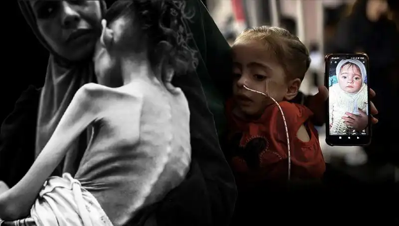 25 Kilodan 10 Kiloya Düşen Meryem’in Sıradışı Açlıkla Mücadelesi